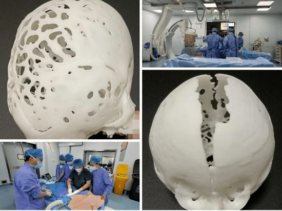 9个月宝宝患罕见病,中山一院贵州医院多学科合作为其"改头换面"_康康