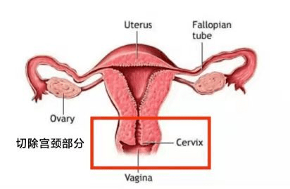 警觉那个“红颜杀手”！不痛不痒，且发病年龄趋于低龄化！