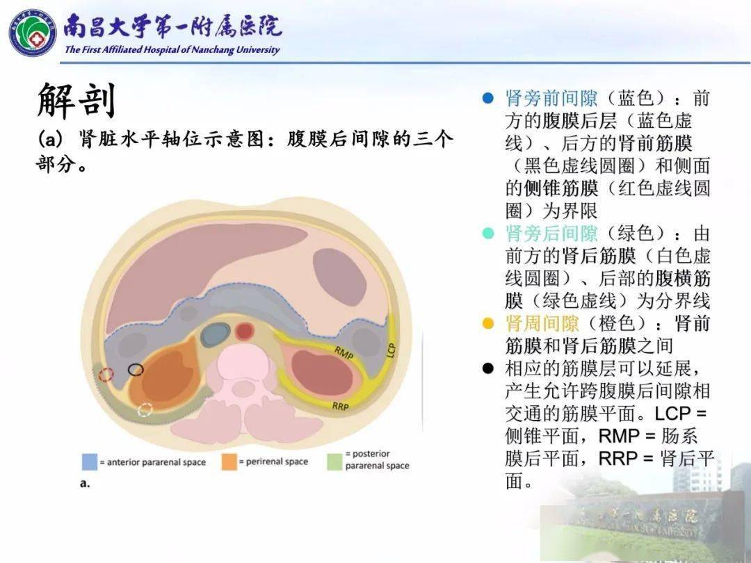 常见腹膜后肿瘤的诊断及鉴别诊断