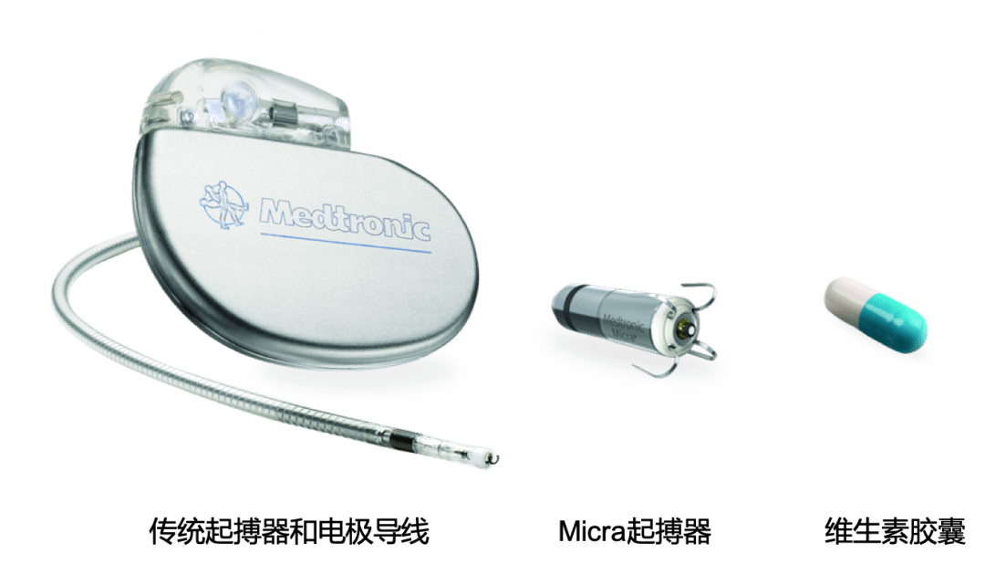 建议陈伯伯安装新一代的双腔无导线起搏器(micra av)系统,陈伯伯听了