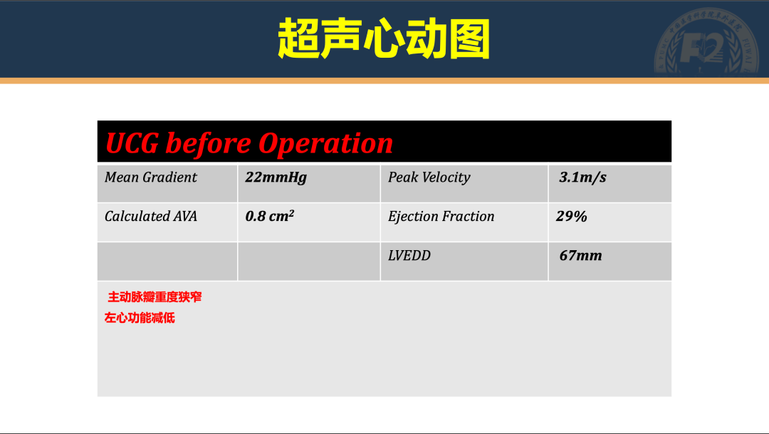 入院超声心动图基本情况,既往病史,合并症和nt-probnp患者基本资料术