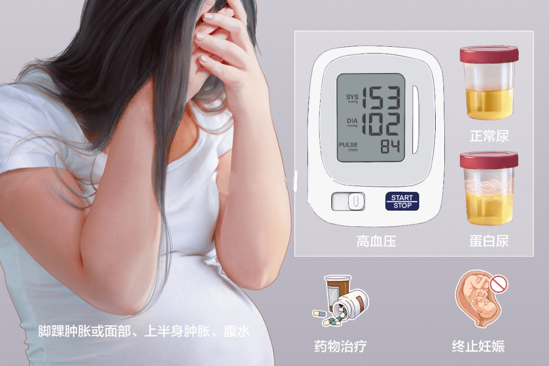 子痫前期日科普之二——子痫前期_胎盘_进行_血管