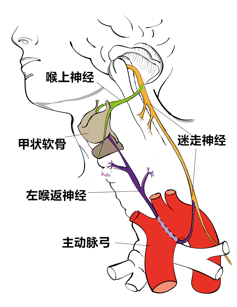 如果聲帶無法外展,也就是