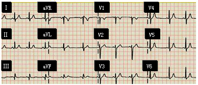 窦性_诊断_答案