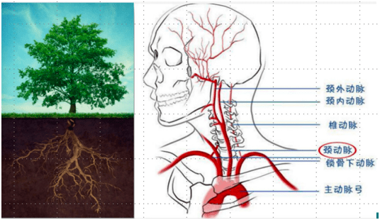 动脉树状图图片