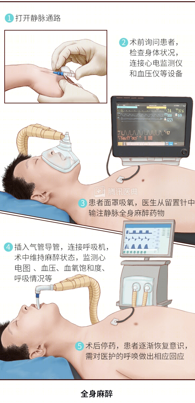 麻醉医生说麻醉_手术_患者_术者
