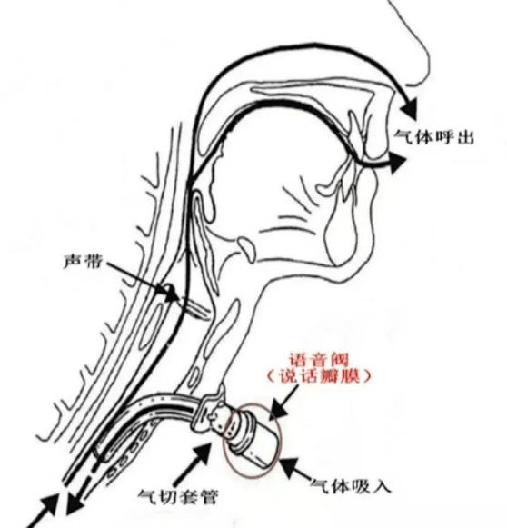 气管与胃管的结构图图片