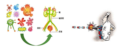 (5)避免不必要的膀胱沖洗.