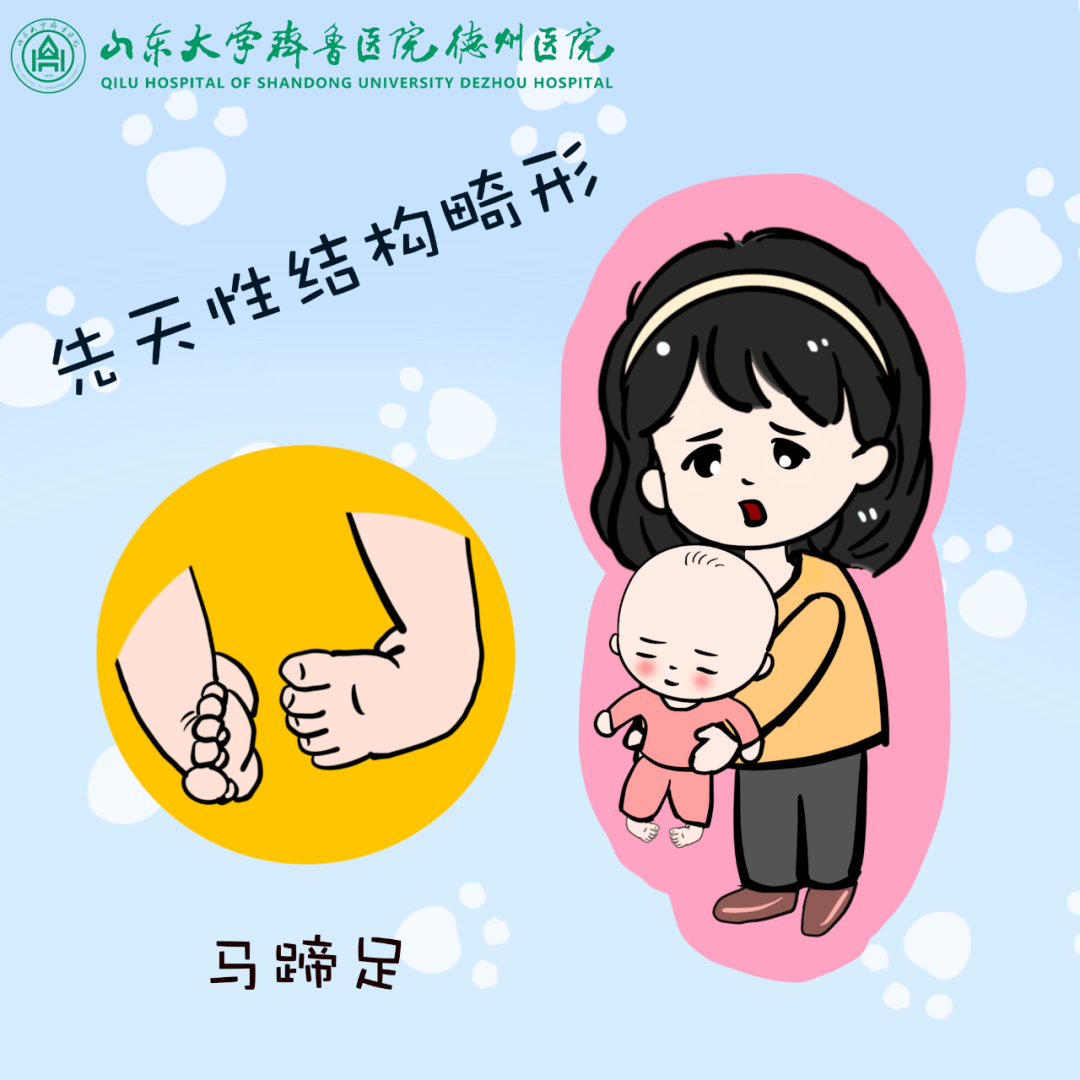 先天性结构畸形患儿家长看过来_德州_救助_治疗