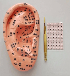 小耳朵发挥大作用——中医特色耳穴贴敷在耳鼻喉科的应用