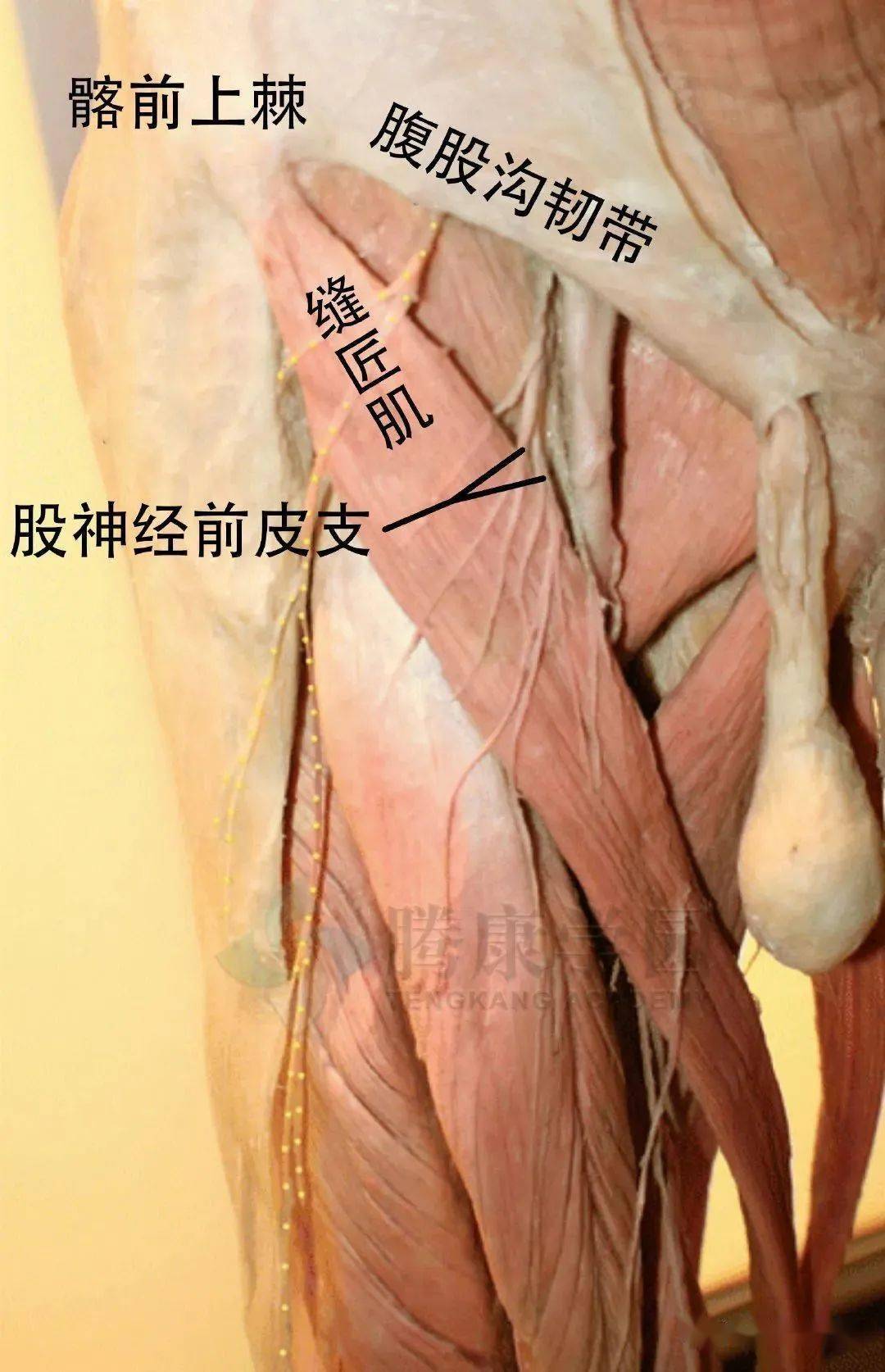 在腹股沟韧带下方,刺穿阔筋膜(通常是缝匠肌)约 7