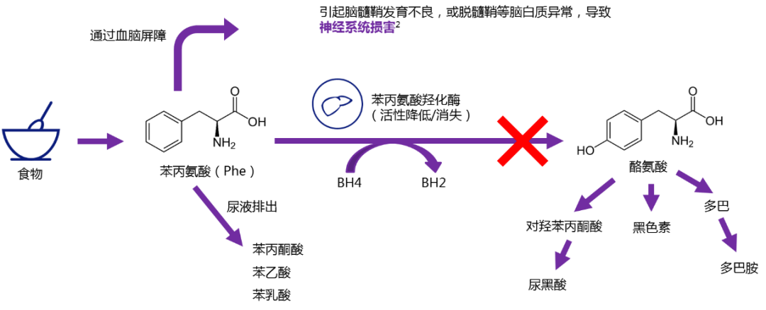 苯丙酮尿症发病机制图片