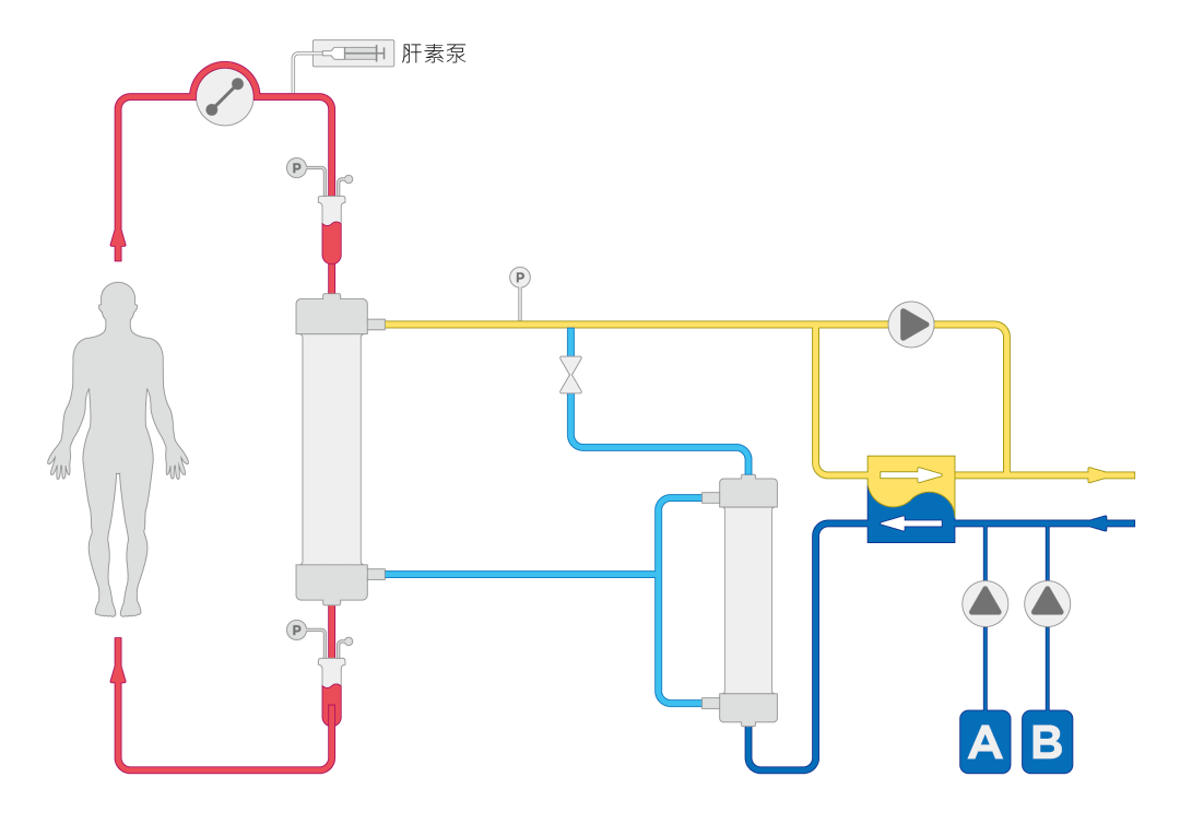 血液灌流安装图图片