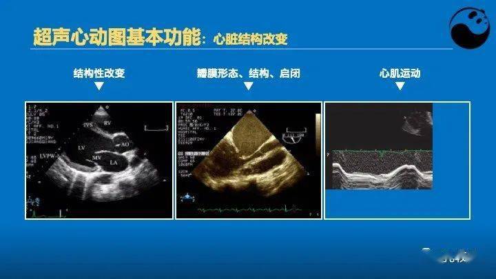 临床医生如何解读超声心动图报告_心脏_病例_患者
