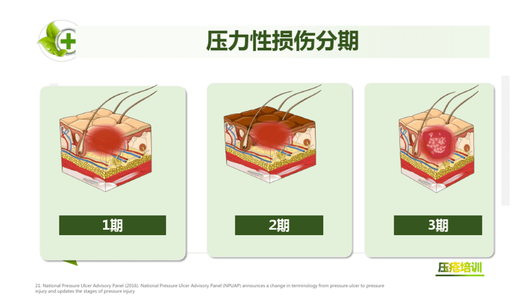【ppt】医疗器械相关压力性损伤及预防