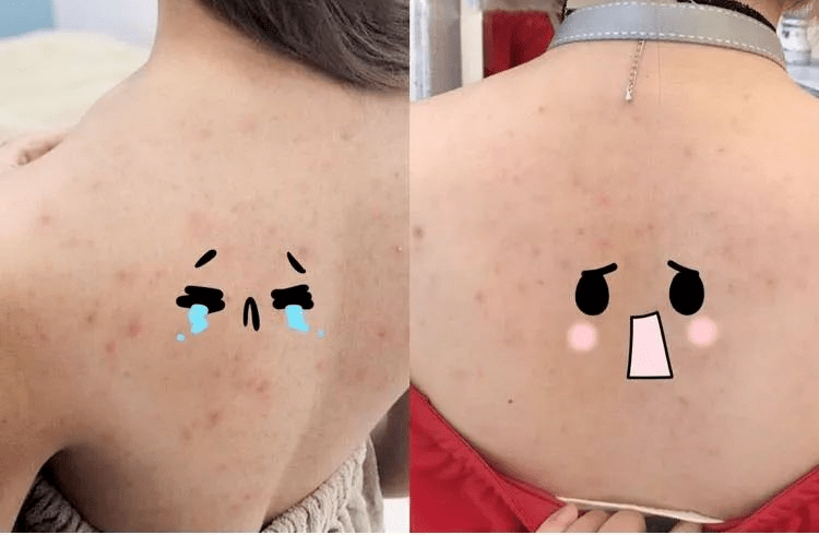 搓澡从此不求人!