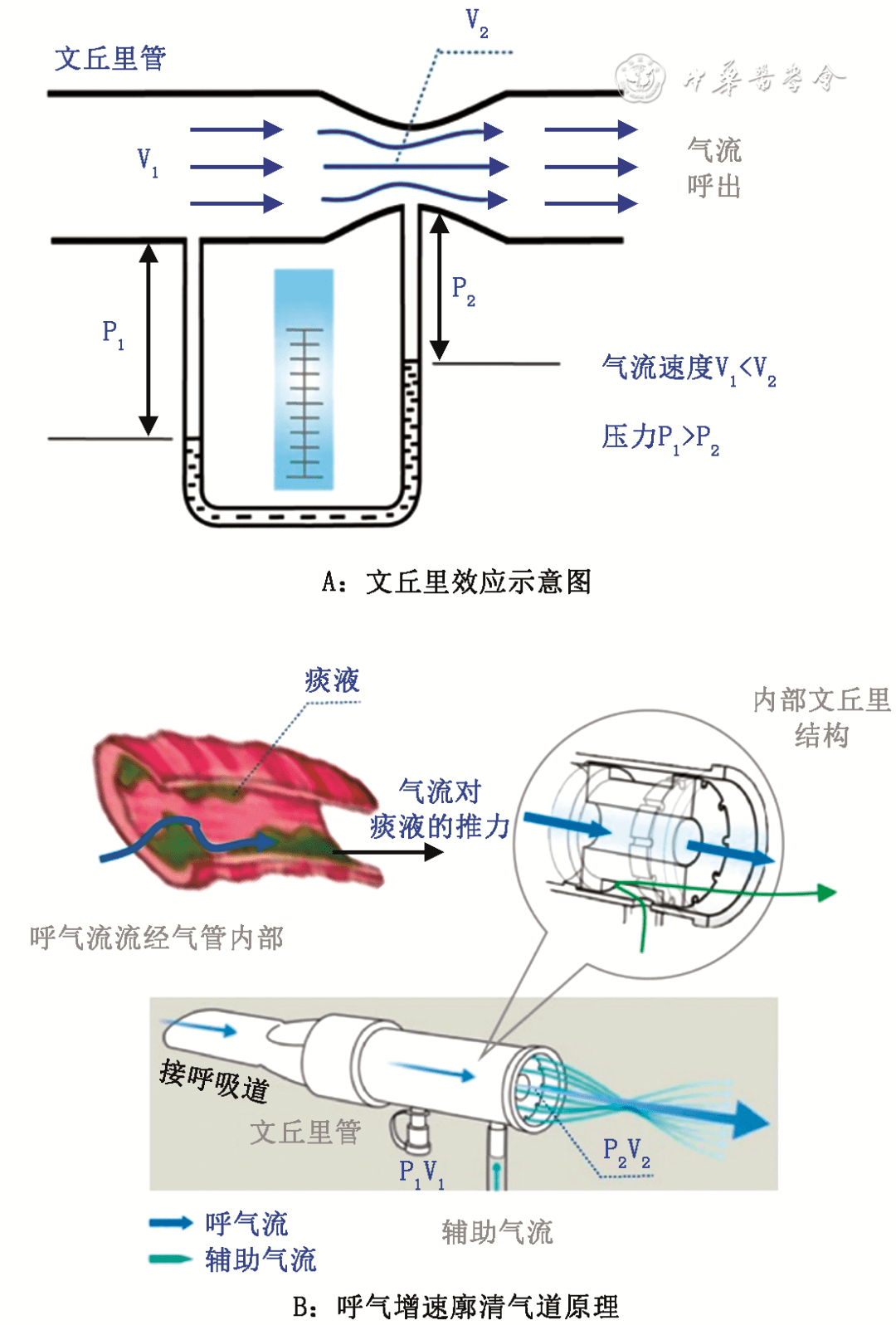 增加呼气流速:2009年推出了一种新型的act呼气流量加速器