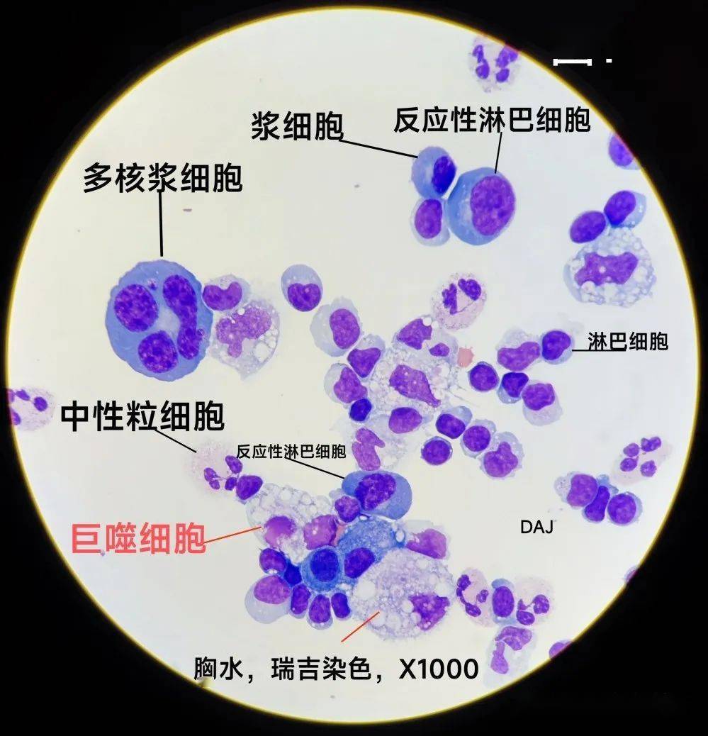 多圆核巨核细胞图片