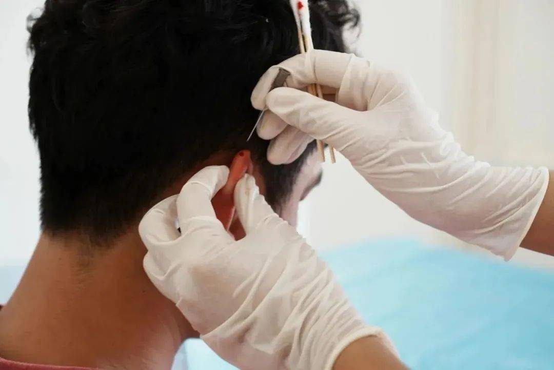 近期"红眼病"高发,中医有良方_野菊花_治疗_太阳