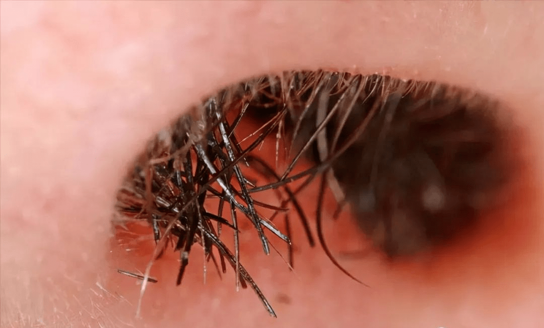 早知道早受益_鼻腔_细菌_鼻粘膜