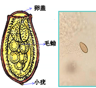 肝吸虫的发育要经历成虫,虫卵,毛蚴,胞蚴,雷蚴,尾蚴,囊蚴及幼虫等8个