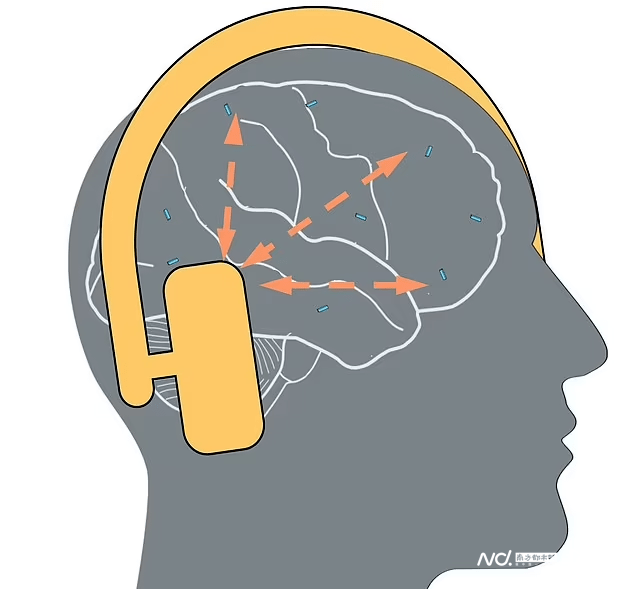 超迷你芯片植入大腦,能用意念控制電腦_研究_信號_技術