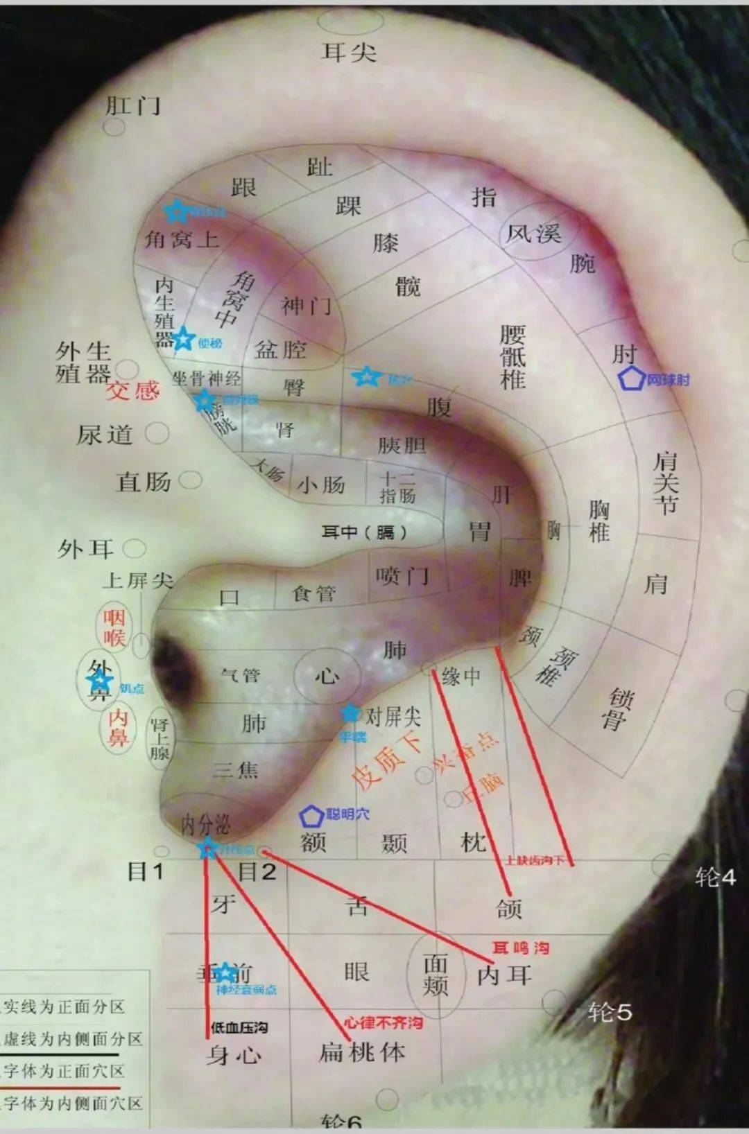 耳穴也叫反应点,敏感点,压痛点,阳性点等,是诊断,治疗疾病的特定点