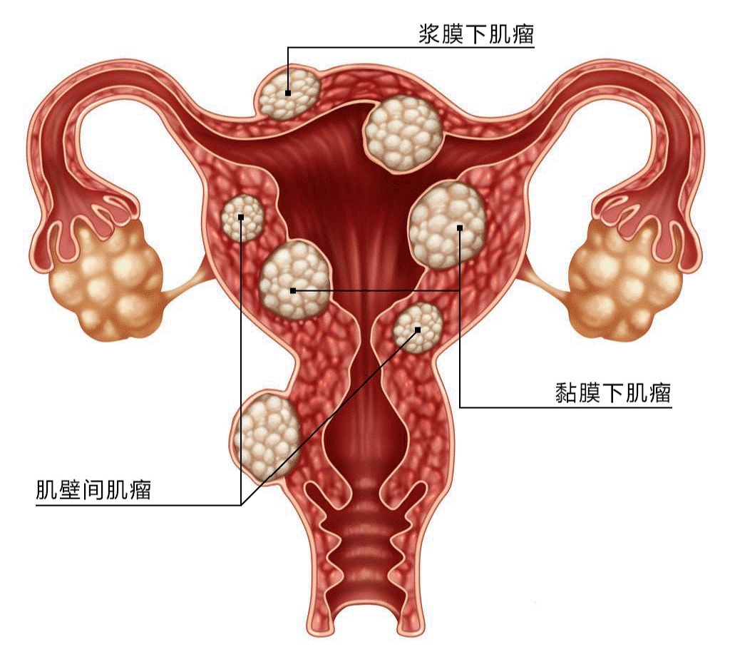 怀孕15周子宫位置图图片