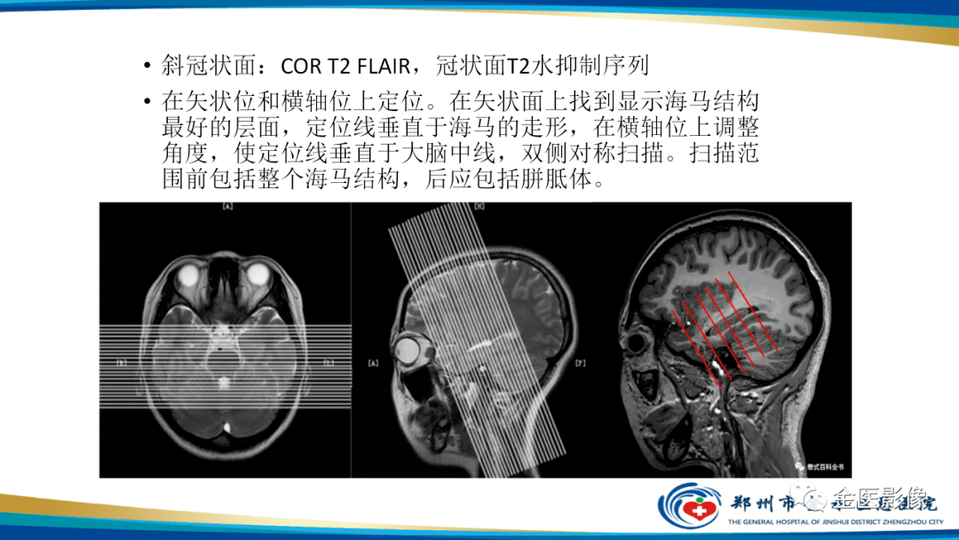 头颅海马的解剖结构图图片