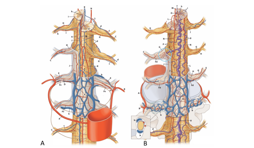 jnis中文版丨于加省教授导读:锥束ct在硬脊膜及硬脊膜外动静脉瘘的