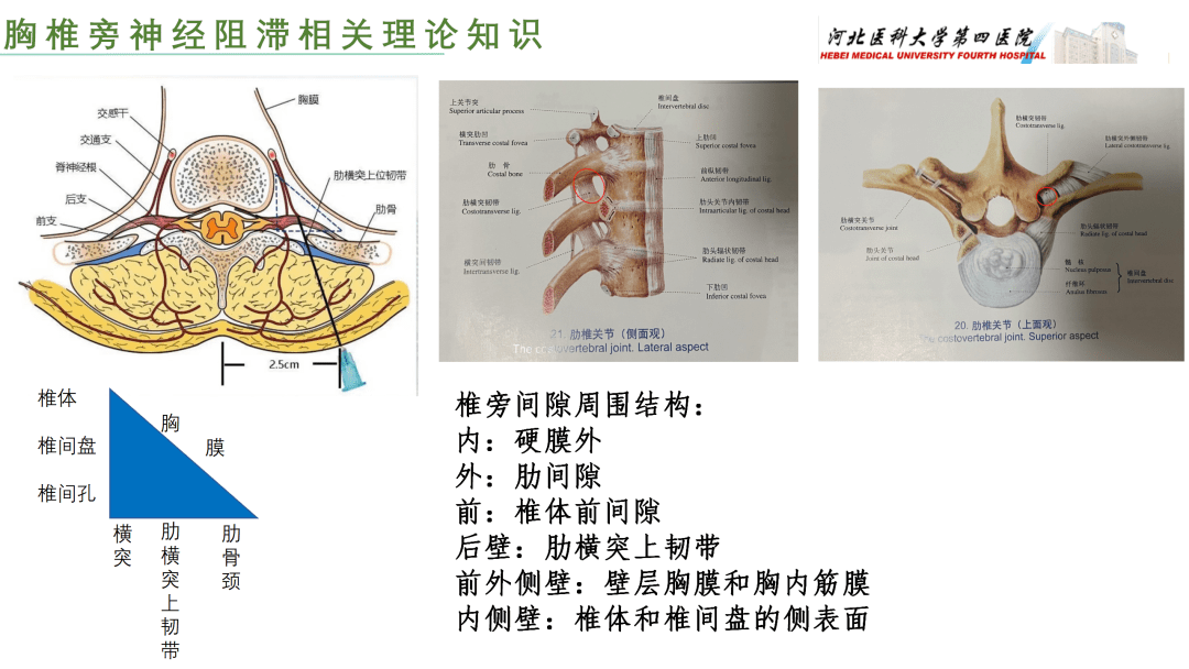 胸椎旁神经阻滞图片