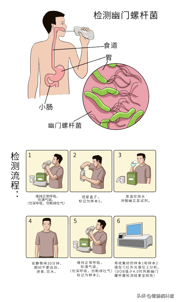 幽门螺杆菌治疗后，会复发吗？