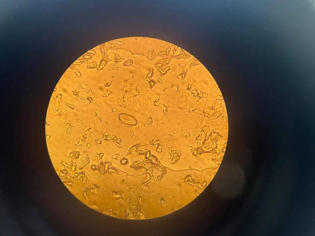 【疾控动态】守护群众健康,预防土源性线虫疾病——区疾控中心微生物