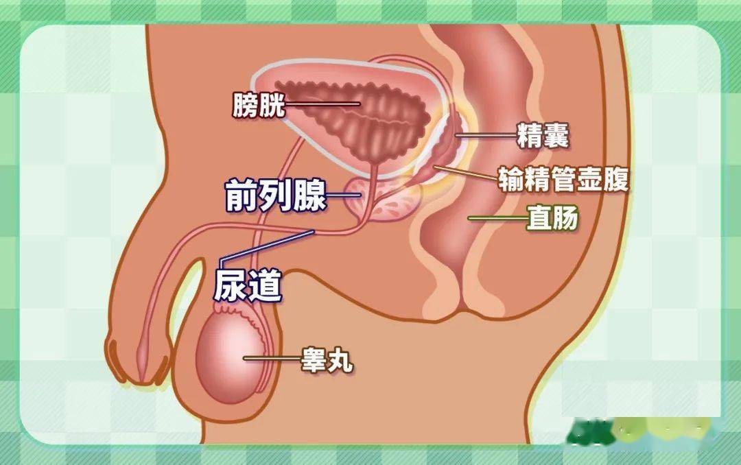 困擾中老年男性的這種癌,做到這一點,能根治!_腫瘤_治療_gleason