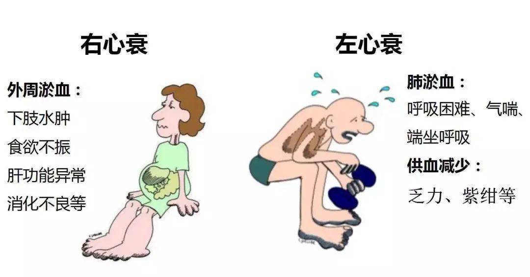 教你如何预防心衰的发生