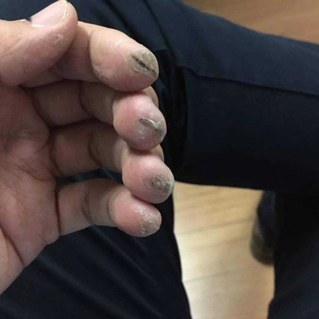 学琴人的手都很好看?看看王羽佳的手