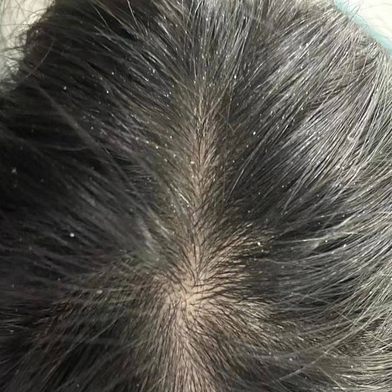 男士去头皮屑好的洗发水有哪些?国货洗发水品牌
