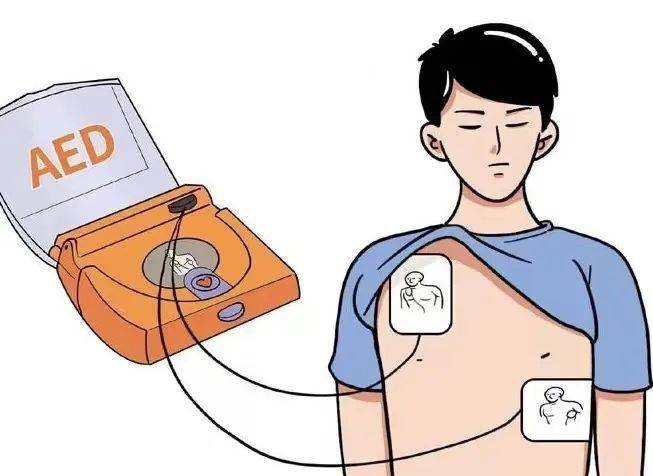 活动预告 | "寻找身边的aed"_定制_图片_奖品