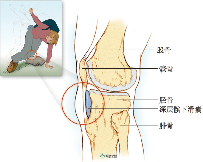 髌下囊图片