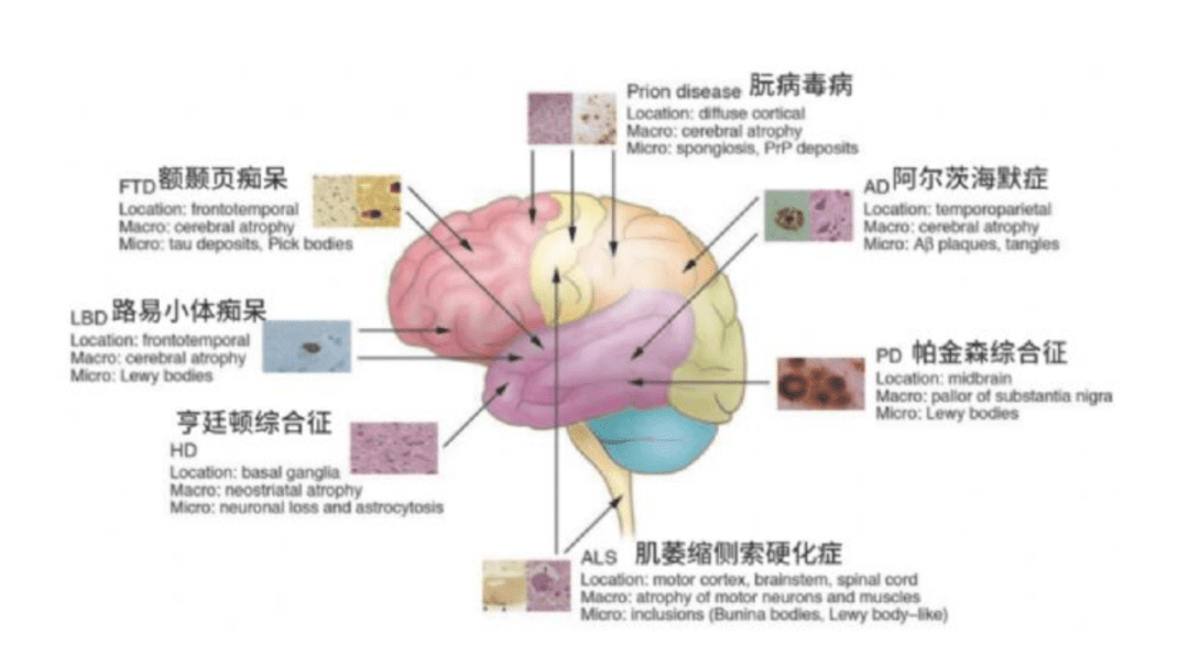 60%的孩子正遭遇腦損傷,家長卻毫不知情_睡眠_影響_小時