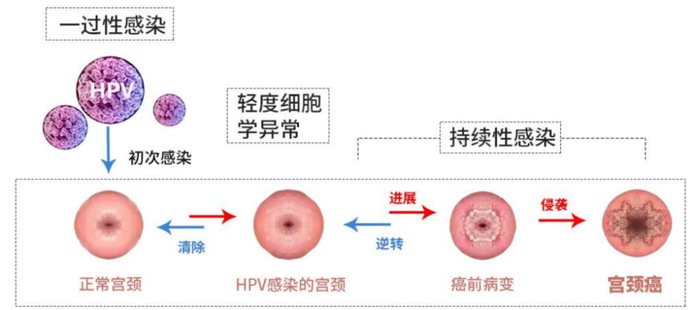 阴道炎:阴道炎是阴道感染引起的炎症,常见的有滴虫性阴道炎,霉菌性